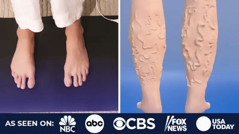 GOOD VEINS - Alfombra para mejorar la circulación en Varices
