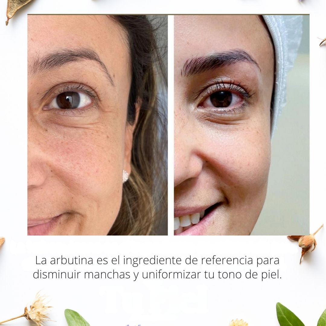 Lumina Arbutin™ – Apoya la reducción visible de manchas y unifica el tono de tu piel