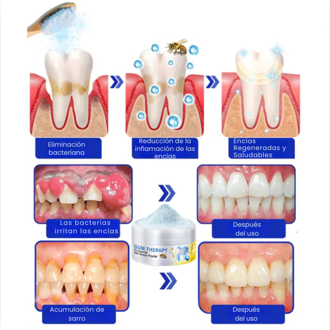 Beelive Dental – Recupera tus encías y luce una sonrisa sana desde casa, sin dolor ni químicos agresivos