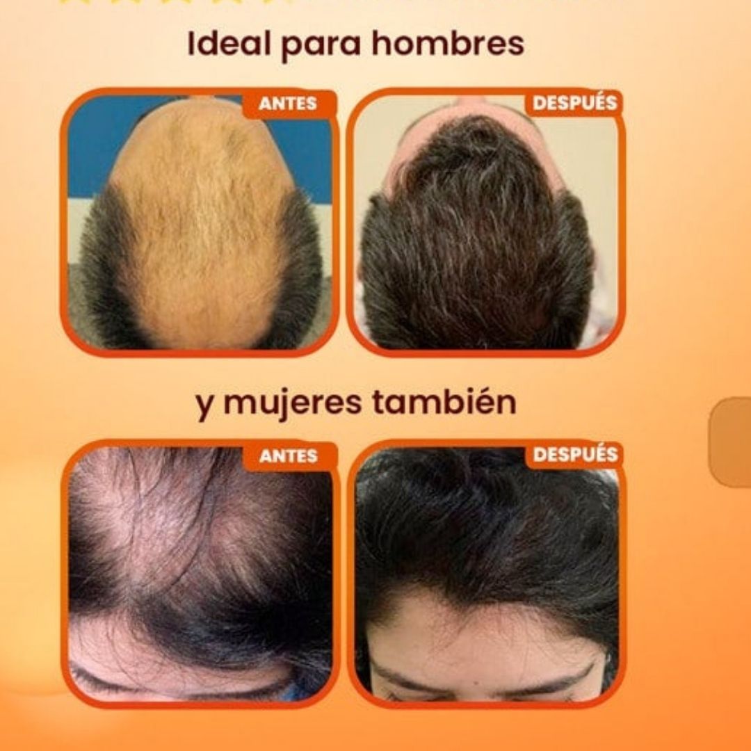 ✨ Recupera tu cabello con Batana Oil X2 Uds – Ritual Capilar Intensivo