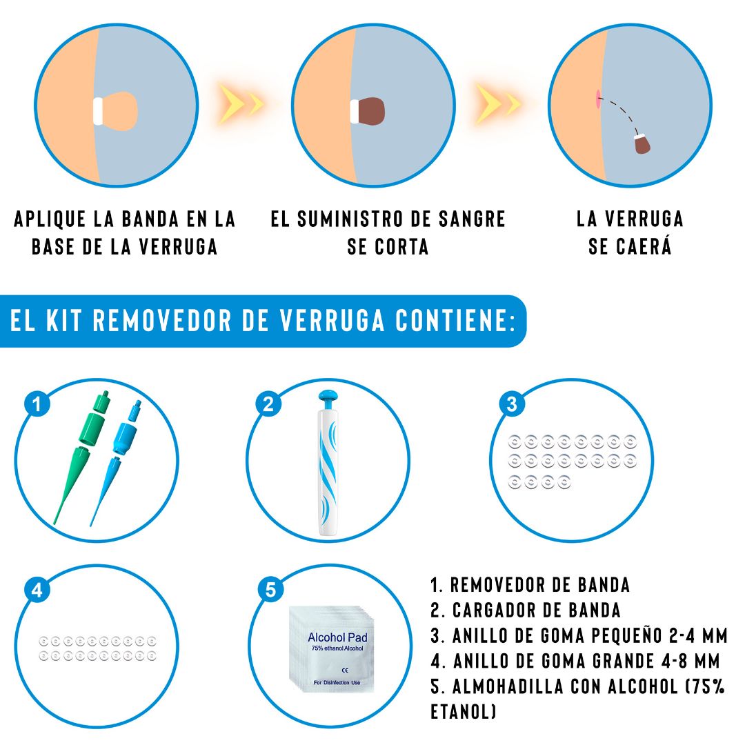 AutoSkin Tag – El método sencillo para decir adiós a las verrugas desde casa