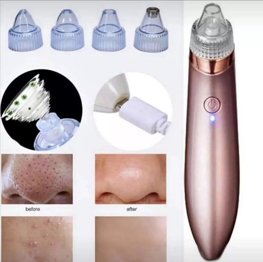 Lunoox™ - Aspirador Eléctrico de Poros Faciales