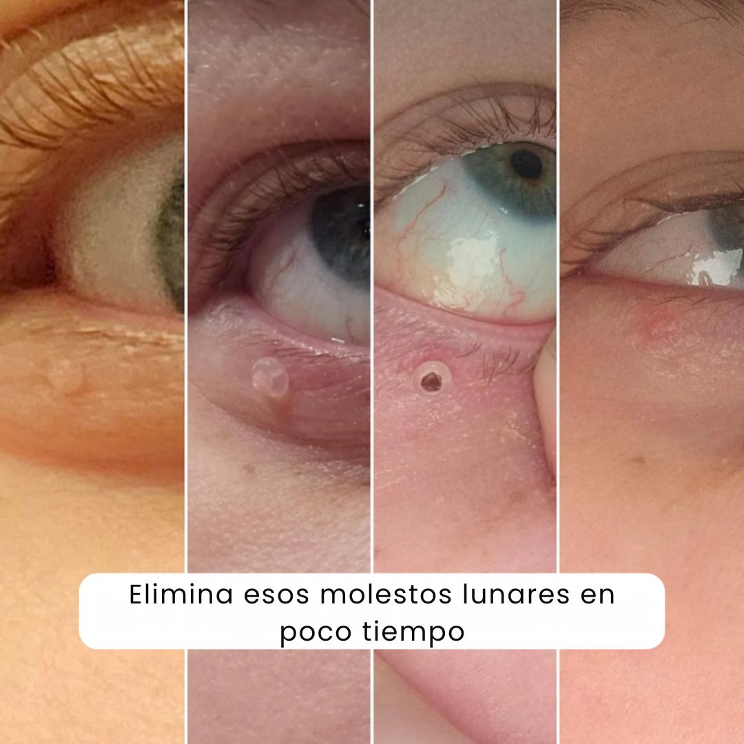 Encabezado