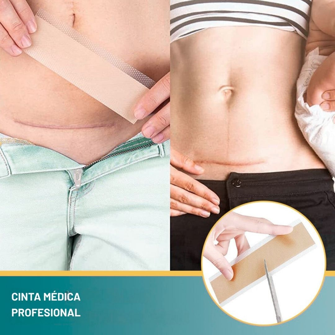 🧴 Silicone Scar | Cinta de Silicona Cicatrizante de Grado Médico – Reutilizable 1.5m - LLEVA GRATIS Parches Kinoki desintoxicantes