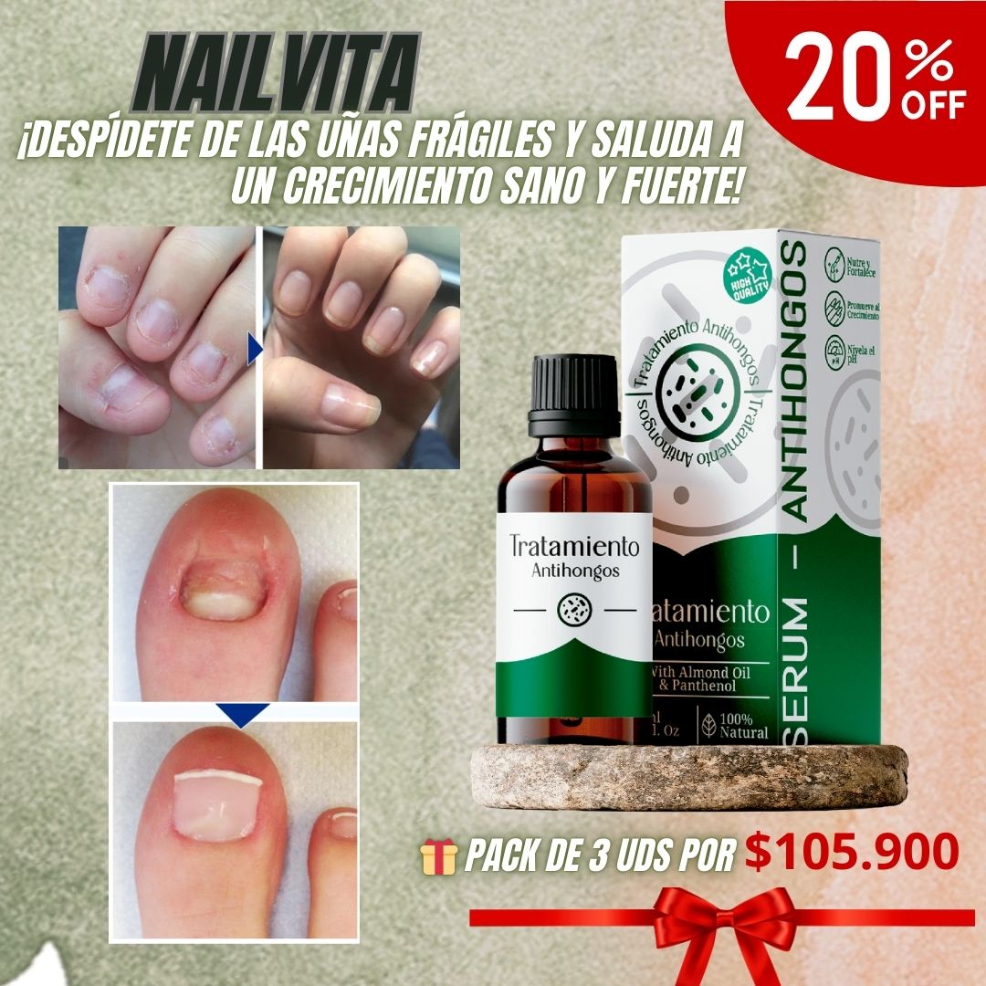 NailVita – Fortalece, repara y elimina hongos desde la raíz de tus uñas